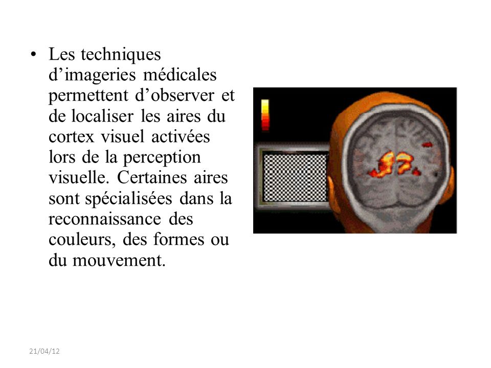Les techniques d’imageries médicales permettent d’observer et de localiser les aires du cortex visuel activées lors de la perception visuelle. Certaines aires sont spécialisées dans la reconnaissance des couleurs, des formes ou du mouvement.