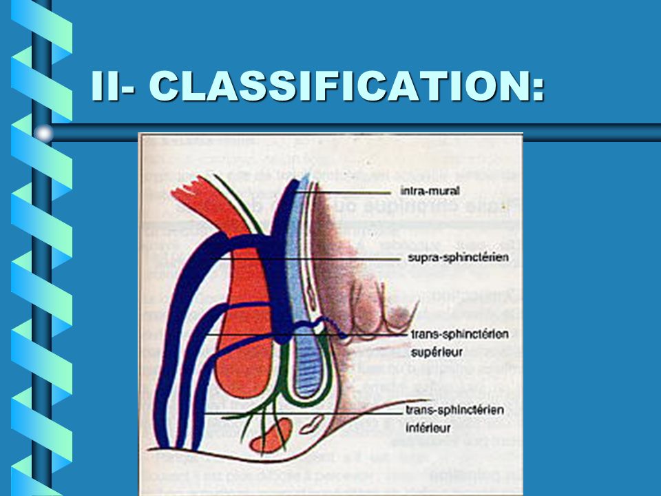 II- CLASSIFICATION: