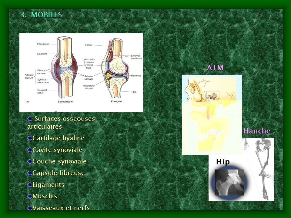 MOBILES ATM Hanche Surfaces osseouses articulaires Cartilage hyaline