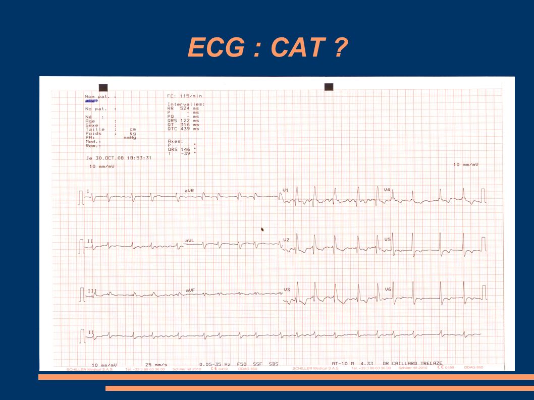 ECG : CAT