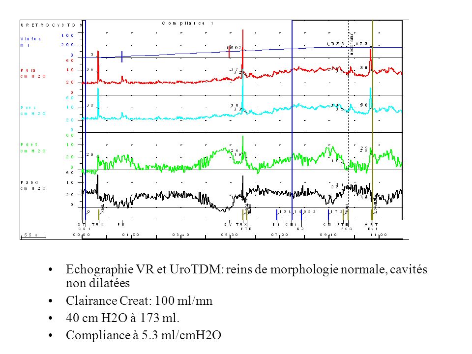 Echographie VR et UroTDM: reins de morphologie normale, cavités non dilatées