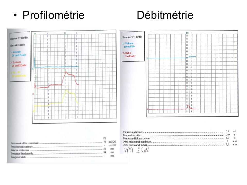 Profilométrie Débitmétrie