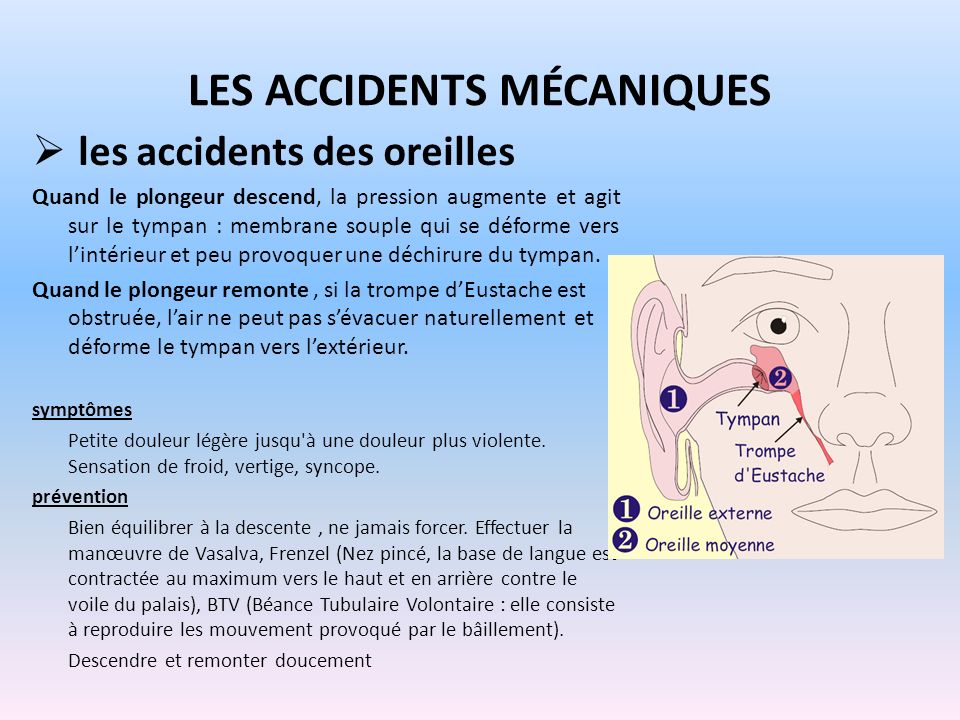 Les accidents mécaniques