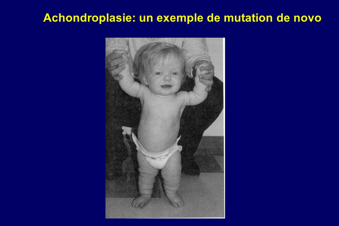 Achondroplasie: un exemple de mutation de novo