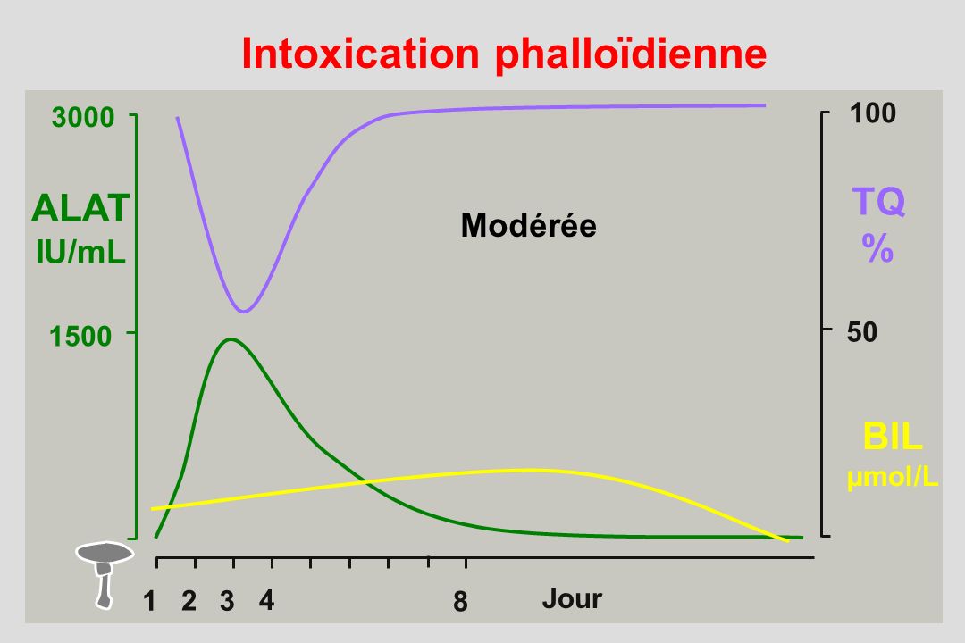 Intoxication phalloïdienne