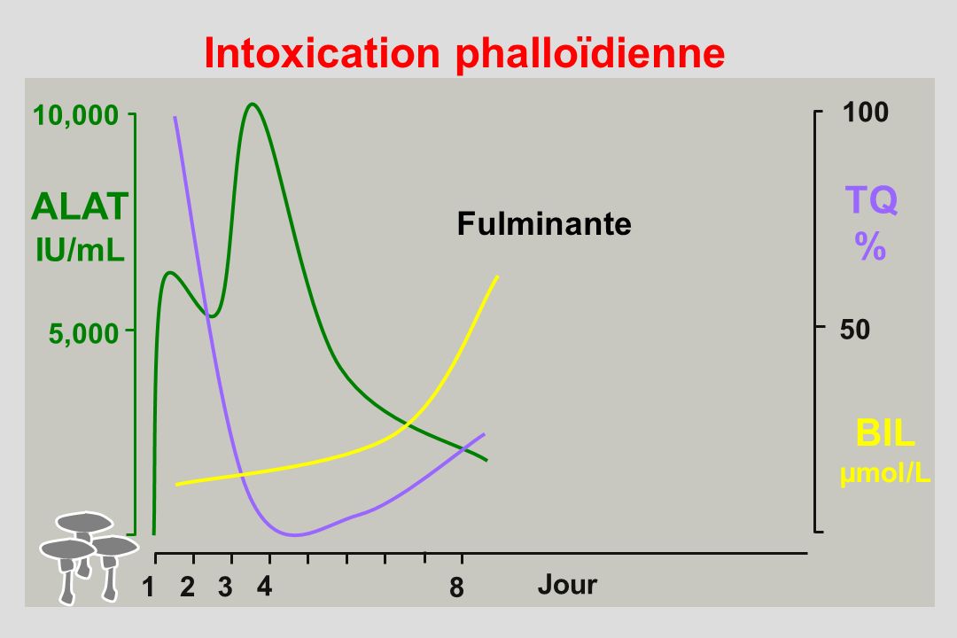 Intoxication phalloïdienne