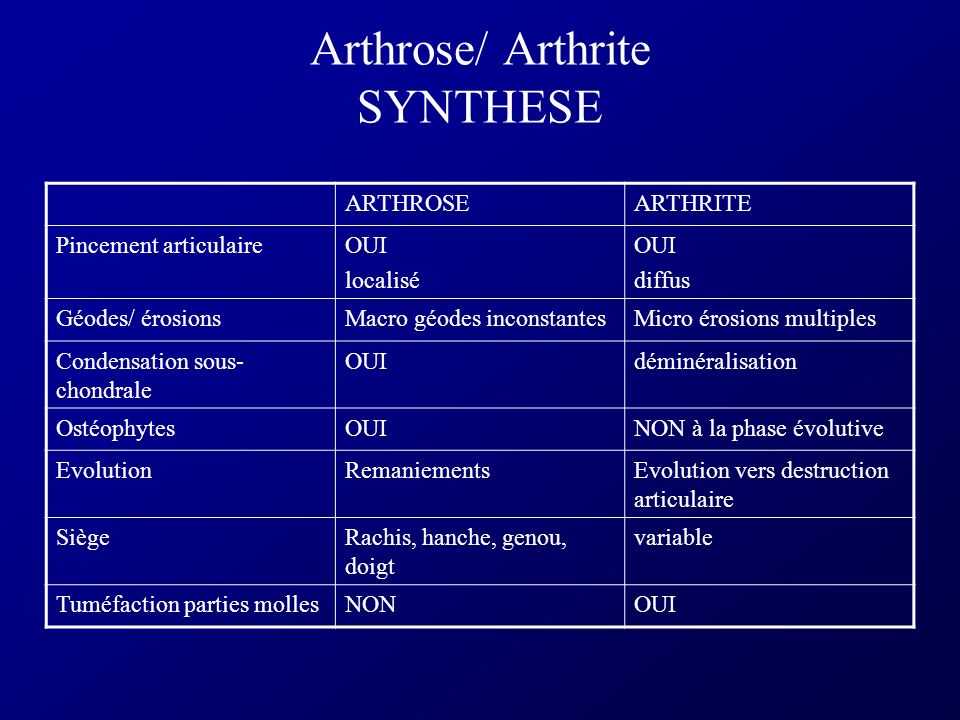 Arthrose/ Arthrite SYNTHESE