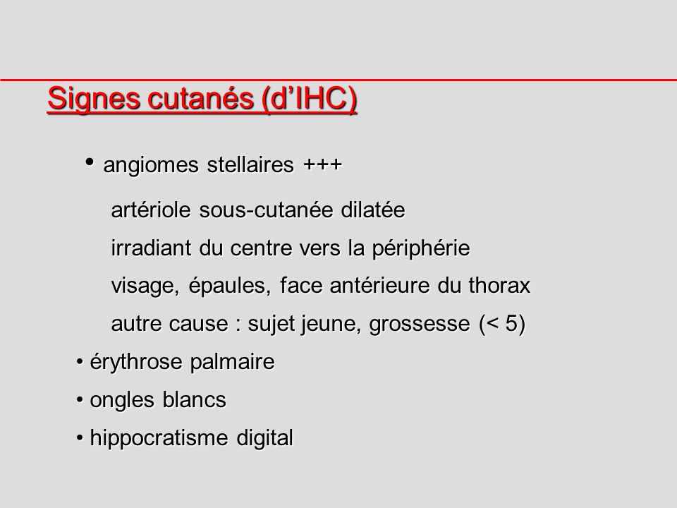 Signes cutanés (d’IHC) • angiomes stellaires +++