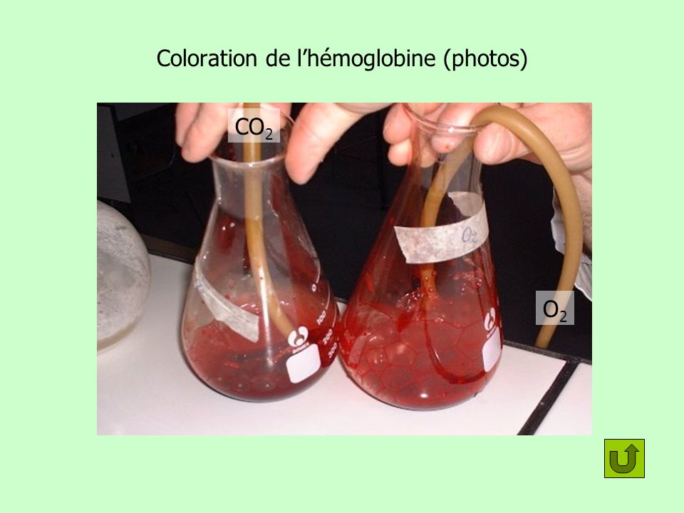 Coloration de l’hémoglobine (photos)
