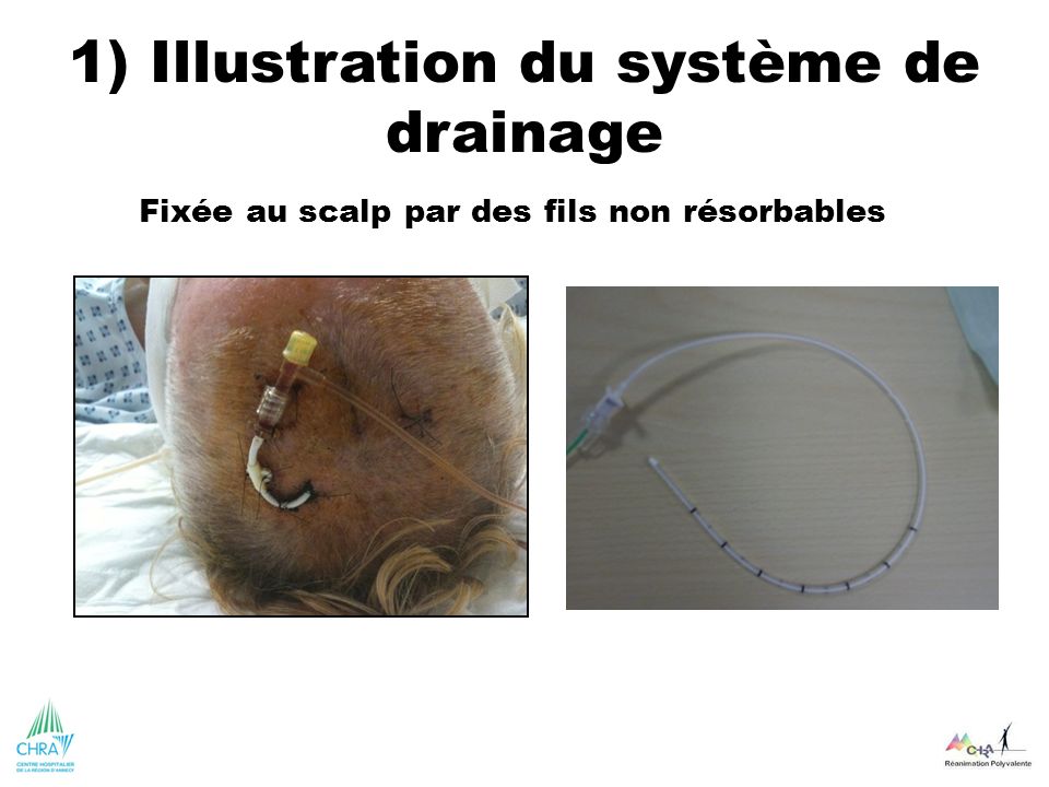 1) Illustration du système de drainage