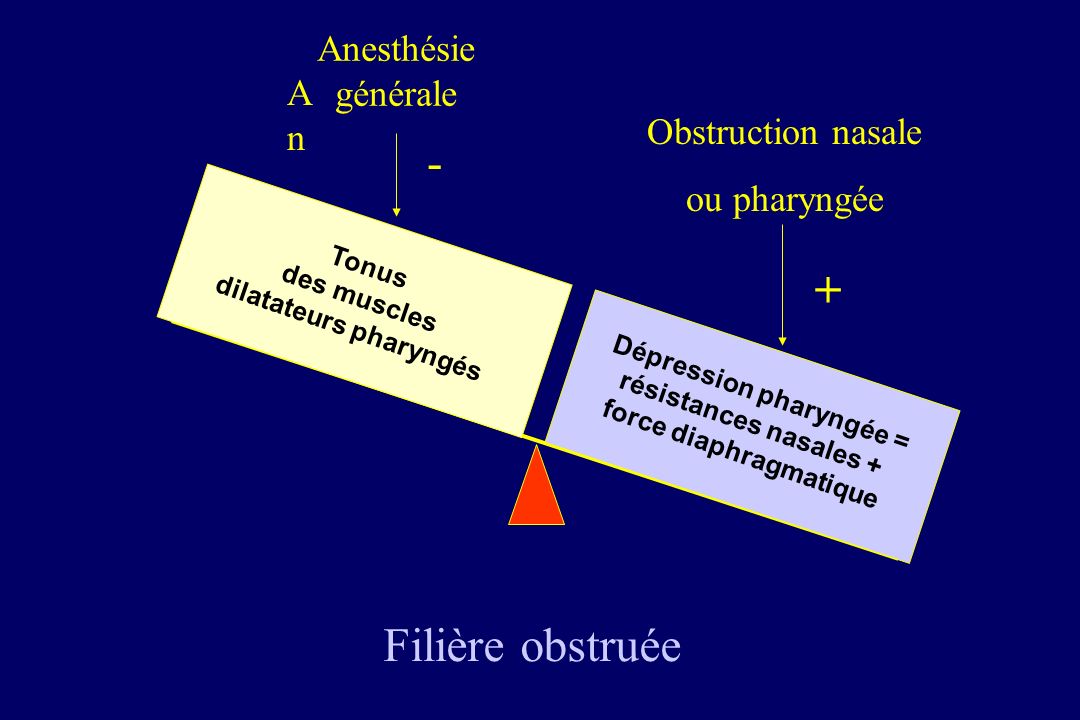 - + Filière obstruée Anesthésie générale An Obstruction nasale