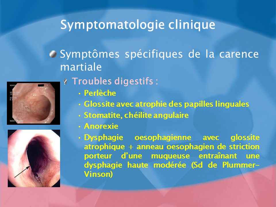 Symptomatologie clinique