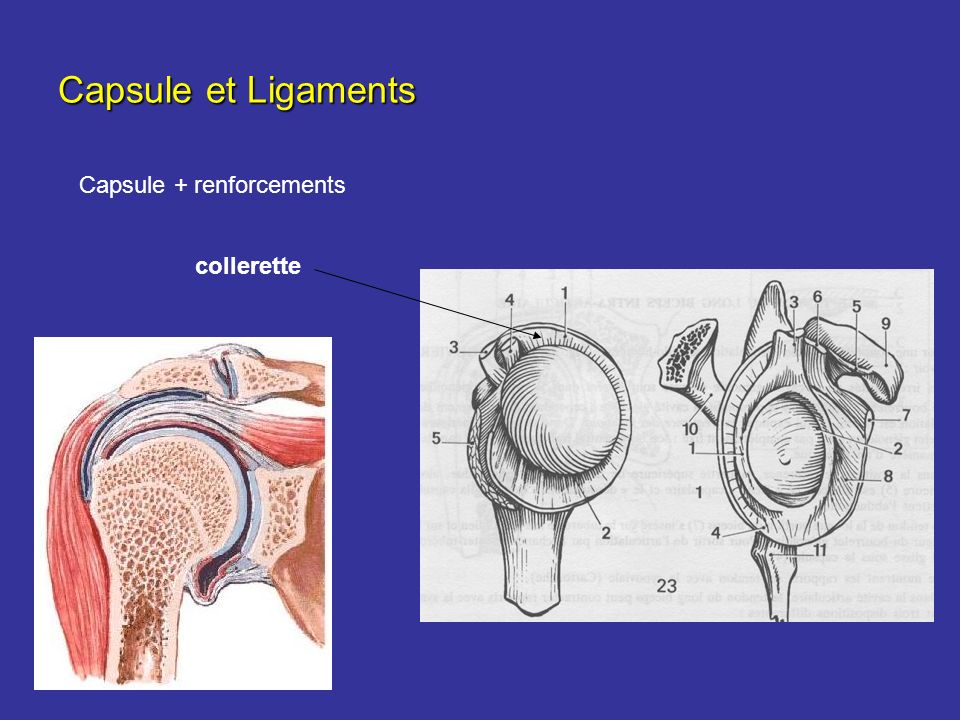 Capsule et Ligaments Capsule + renforcements collerette