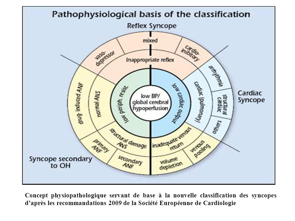 Concept physiopathologique servant de base à la nouvelle classification des syncopes d’après les recommandations 2009 de la Société Européenne de Cardiologie