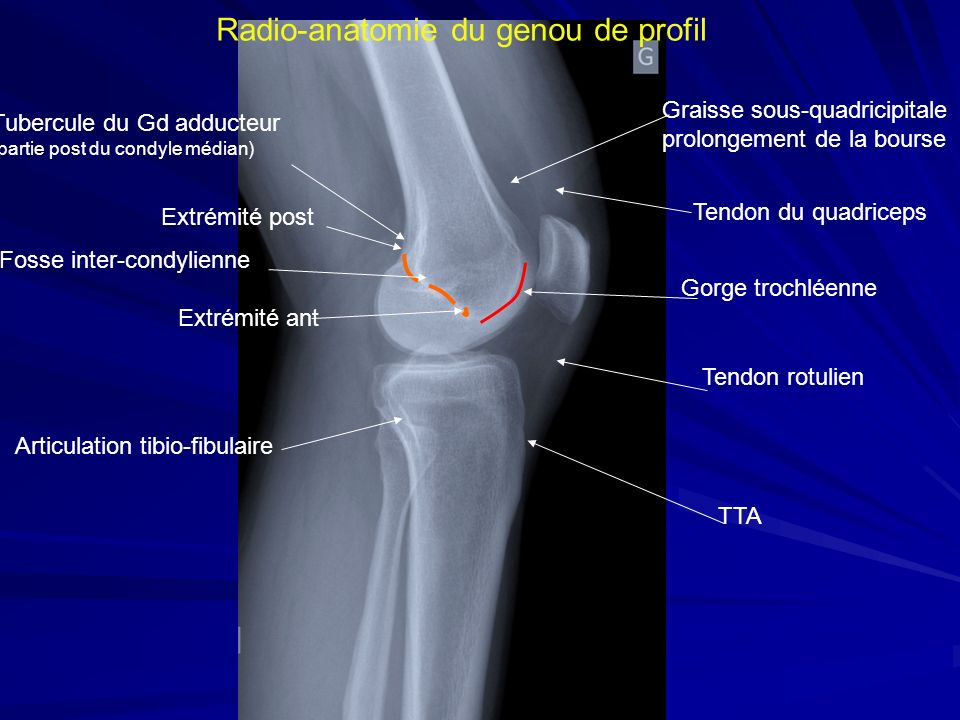 Radio-anatomie du genou de profil