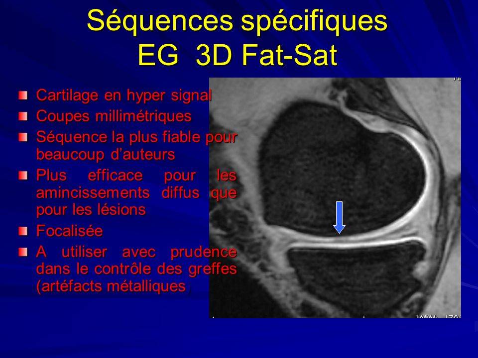 Séquences spécifiques EG 3D Fat-Sat