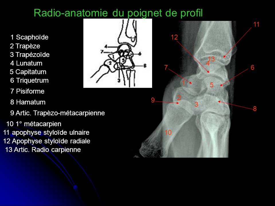 Radio-anatomie du poignet de profil