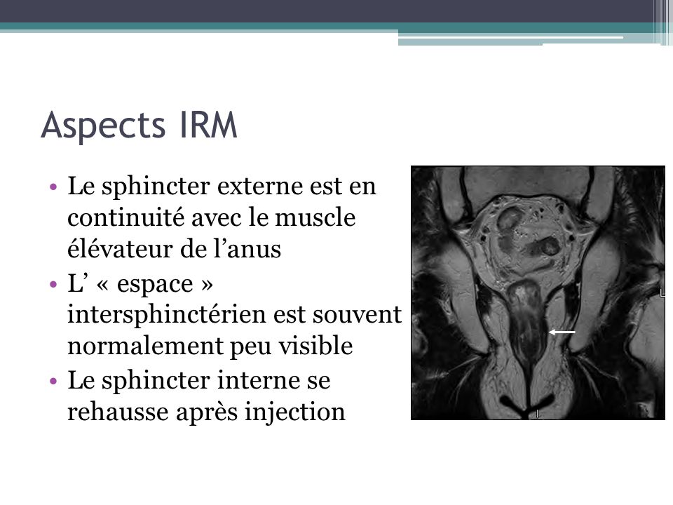 Aspects IRM Le sphincter externe est en continuité avec le muscle élévateur de l’anus.