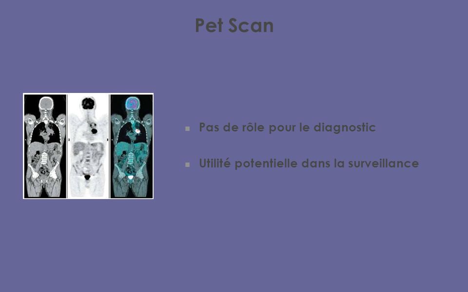 Pet Scan Pas de rôle pour le diagnostic