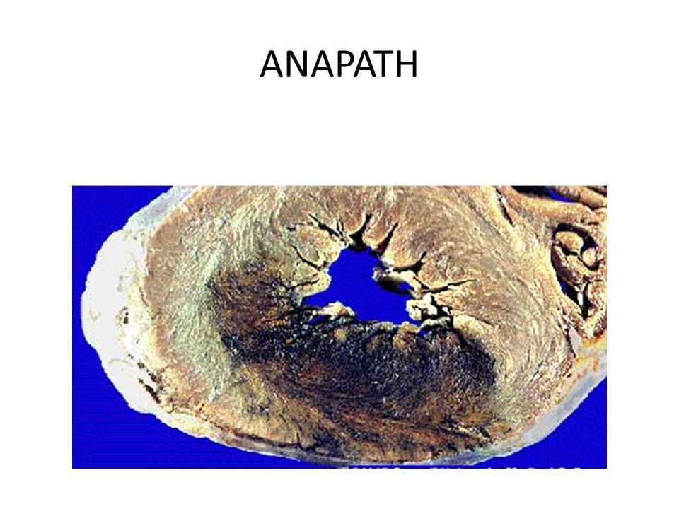 ANAPATH