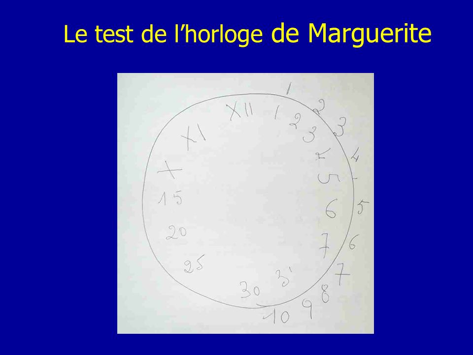 Le test de l’horloge de Marguerite