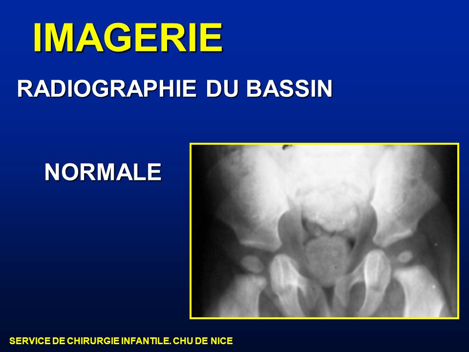 IMAGERIE RADIOGRAPHIE DU BASSIN NORMALE