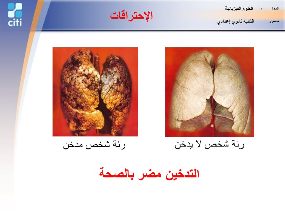 التدخين مضر بالصحة الإحتراقات رئة شخص مدخن رئة شخص لا يدخن
