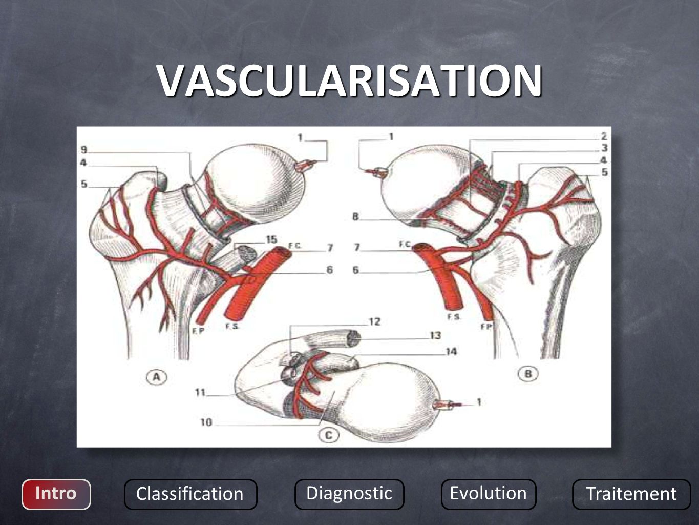 VASCULARISATION Intro Classification Diagnostic Evolution Traitement