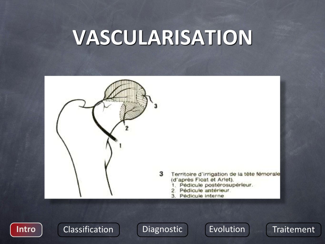 VASCULARISATION Intro Classification Diagnostic Evolution Traitement