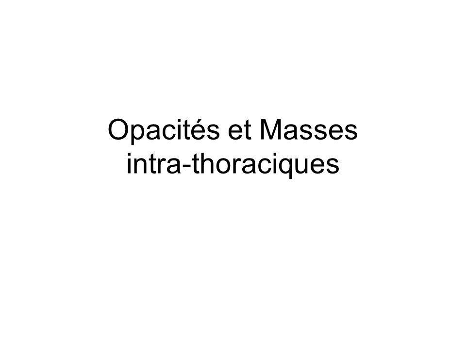 Opacités et Masses intra-thoraciques