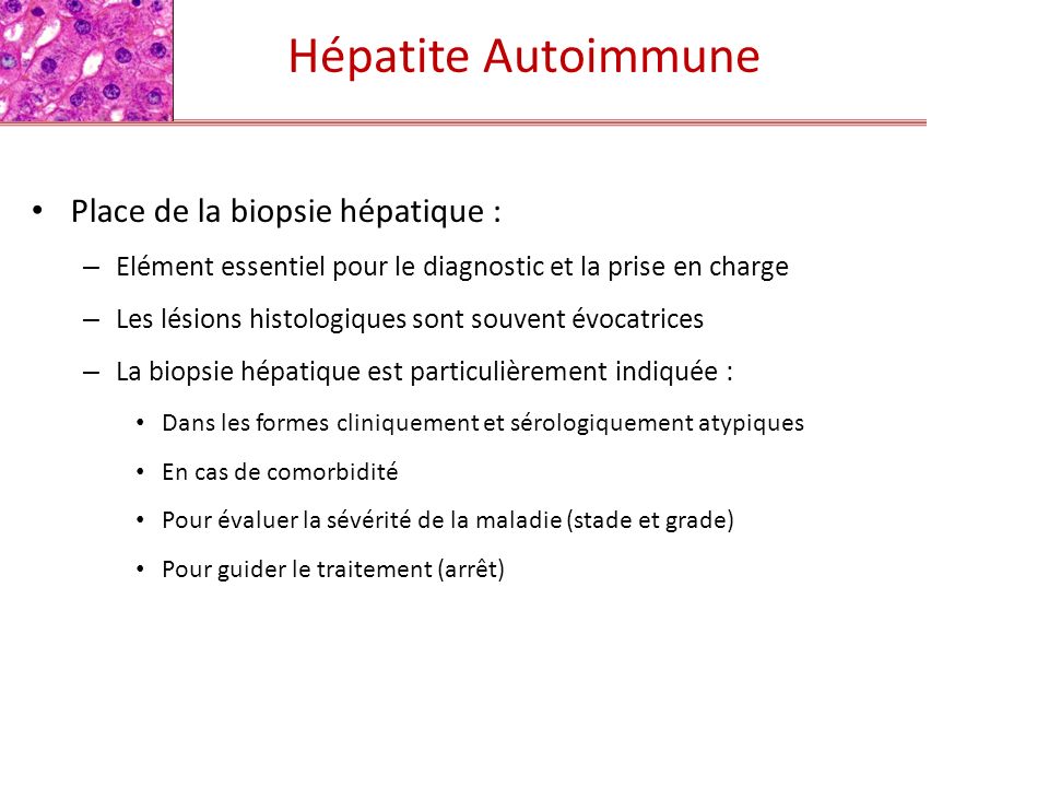 Hépatite Autoimmune Place de la biopsie hépatique :