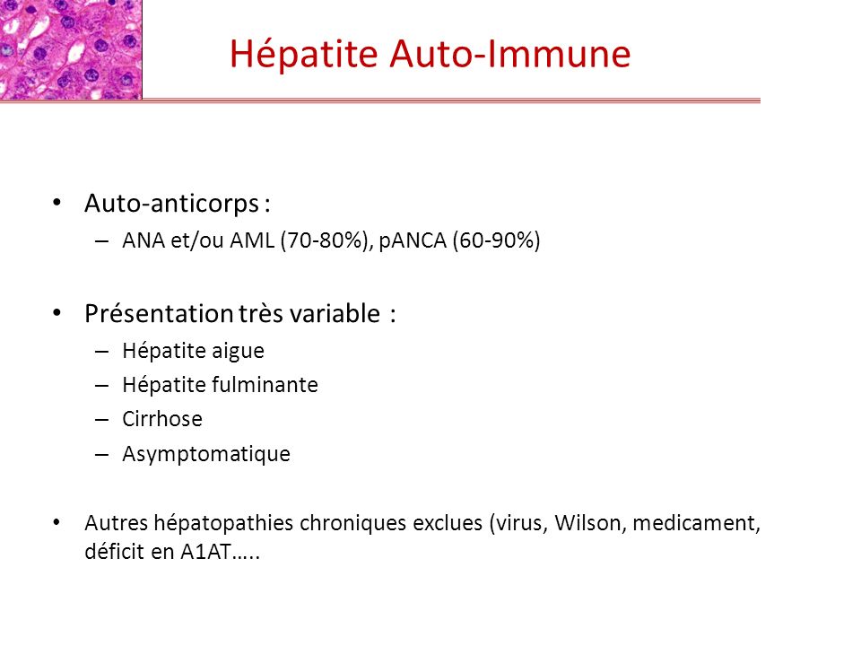Hépatite Auto-Immune Auto-anticorps : Présentation très variable :