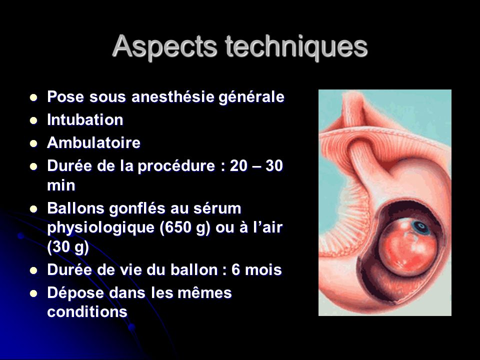 Aspects techniques Pose sous anesthésie générale Intubation