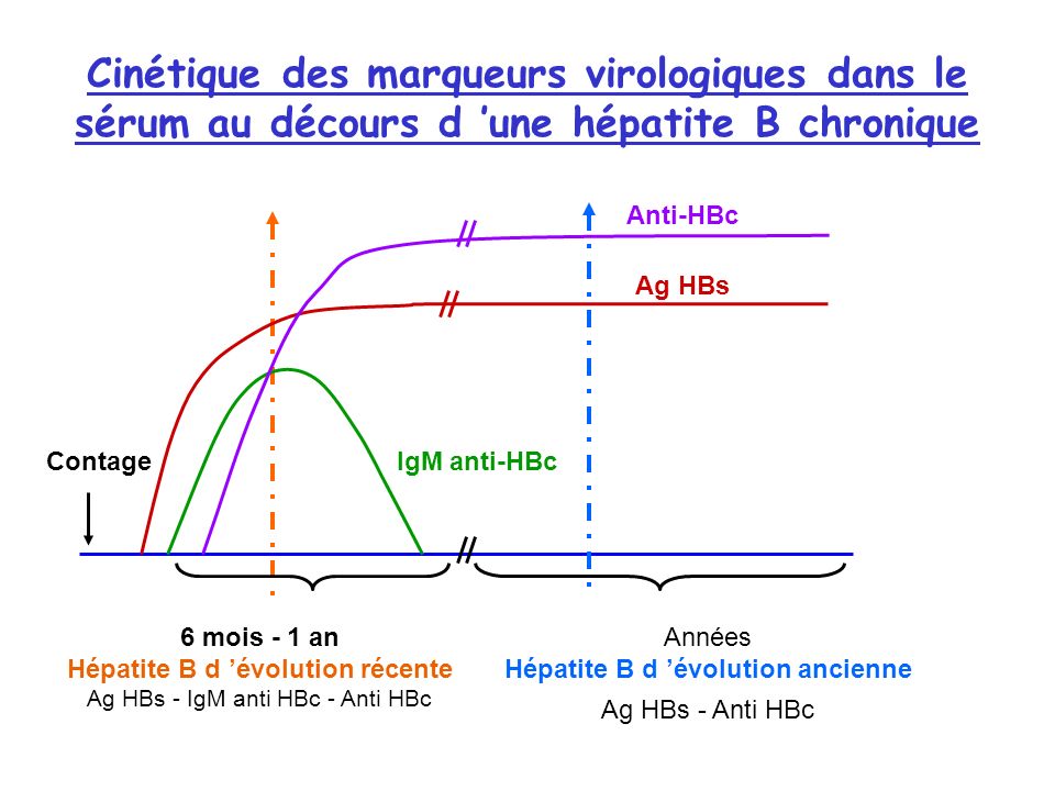 Années Hépatite B d ’évolution ancienne Ag HBs - Anti HBc