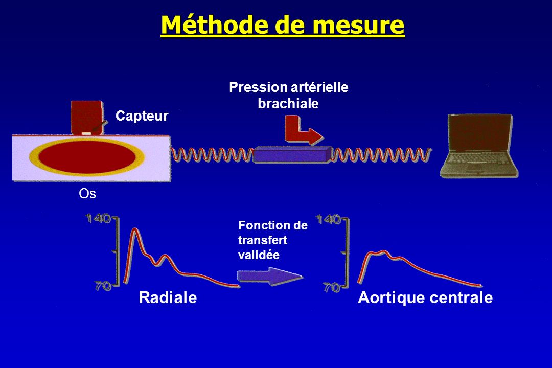 Méthode de mesure Radiale Aortique centrale Pression artérielle