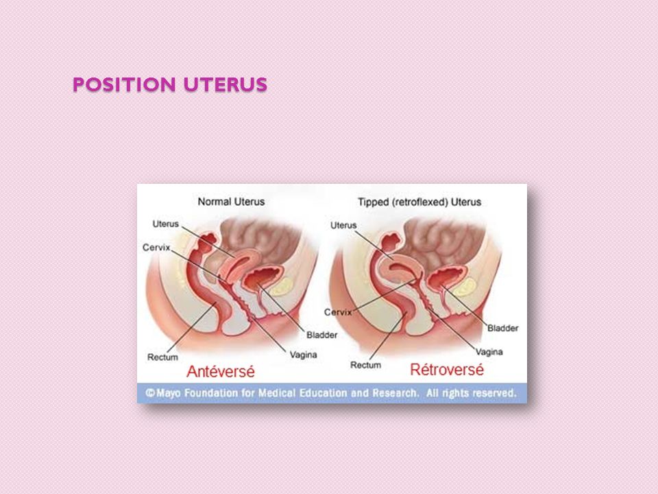 Position uterus