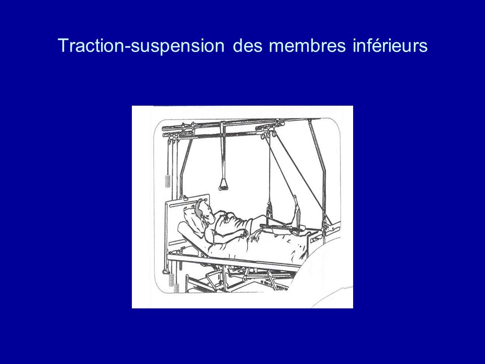 Traction-suspension des membres inférieurs