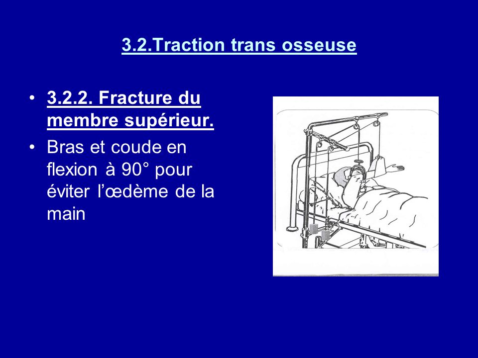 3.2.Traction trans osseuse