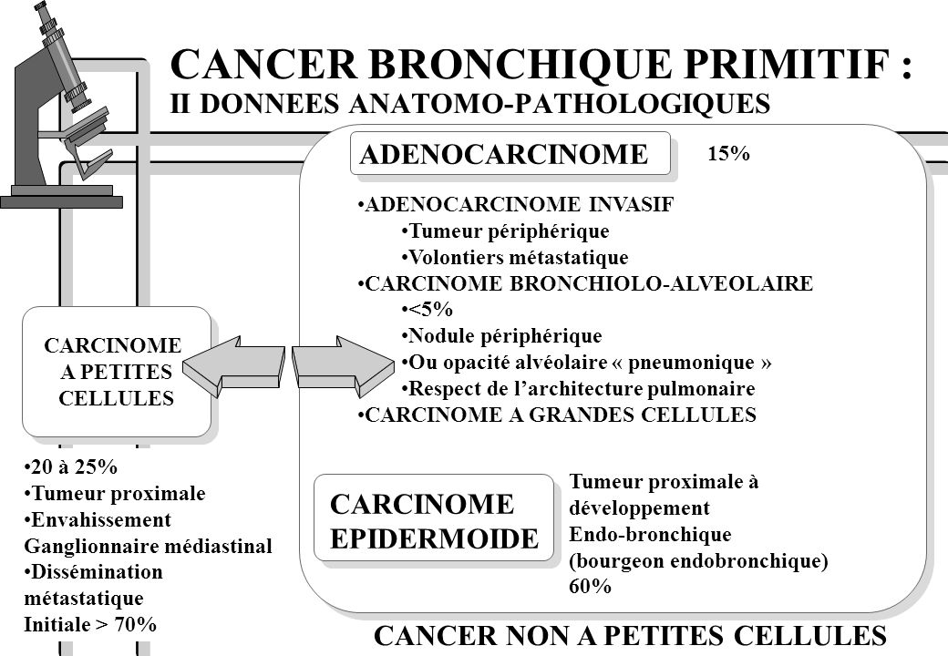 CANCER BRONCHIQUE PRIMITIF : II DONNEES ANATOMO-PATHOLOGIQUES