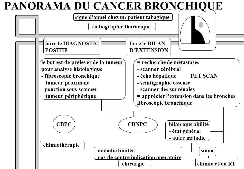 PANORAMA DU CANCER BRONCHIQUE