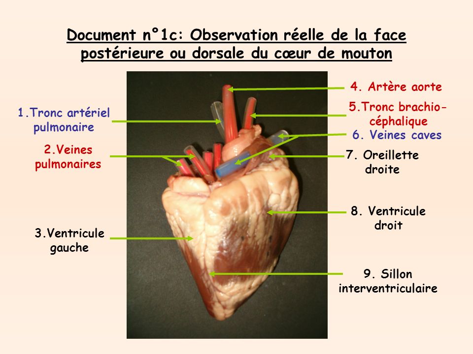 Document n°1c: Observation réelle de la face postérieure ou dorsale du cœur de mouton