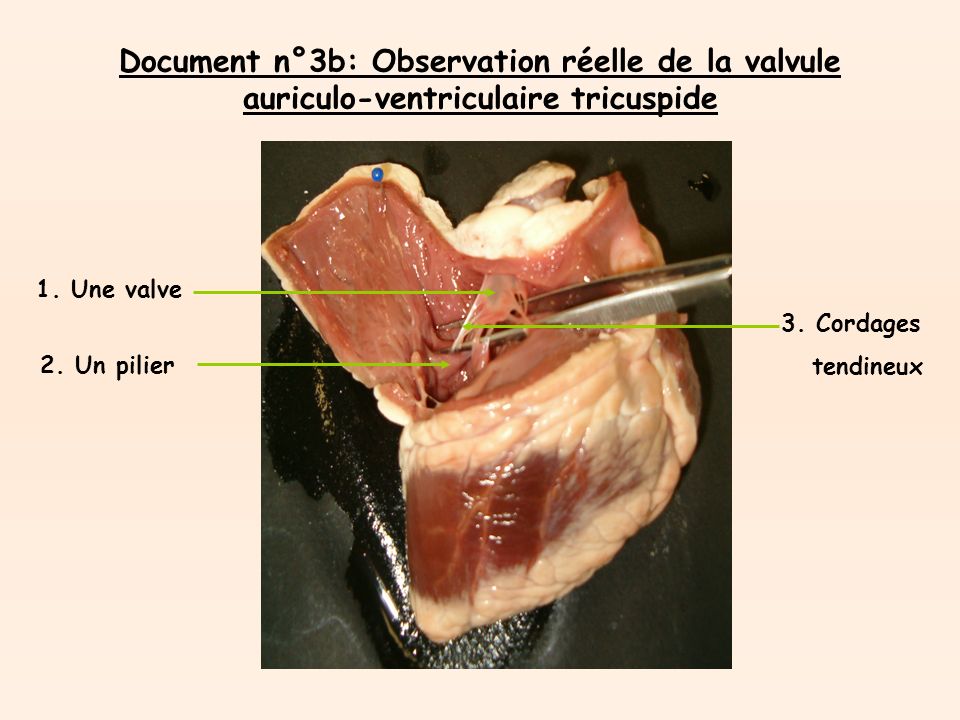 Document n°3b: Observation réelle de la valvule auriculo-ventriculaire tricuspide