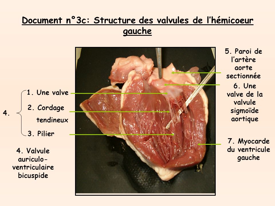 Document n°3c: Structure des valvules de l’hémicoeur gauche