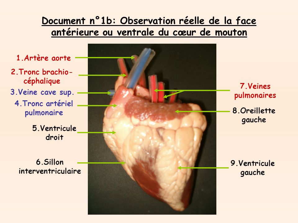 Document n°1b: Observation réelle de la face antérieure ou ventrale du cœur de mouton