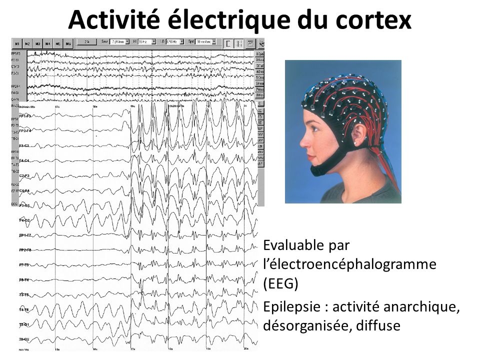 Activité électrique du cortex