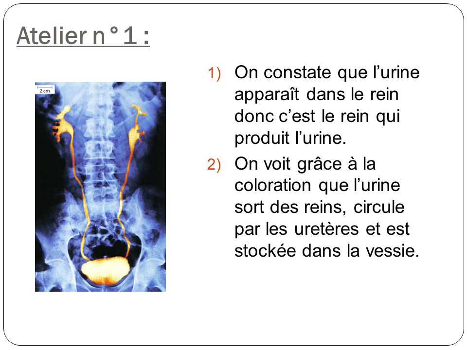 Atelier n°1 : On constate que l’urine apparaît dans le rein donc c’est le rein qui produit l’urine.