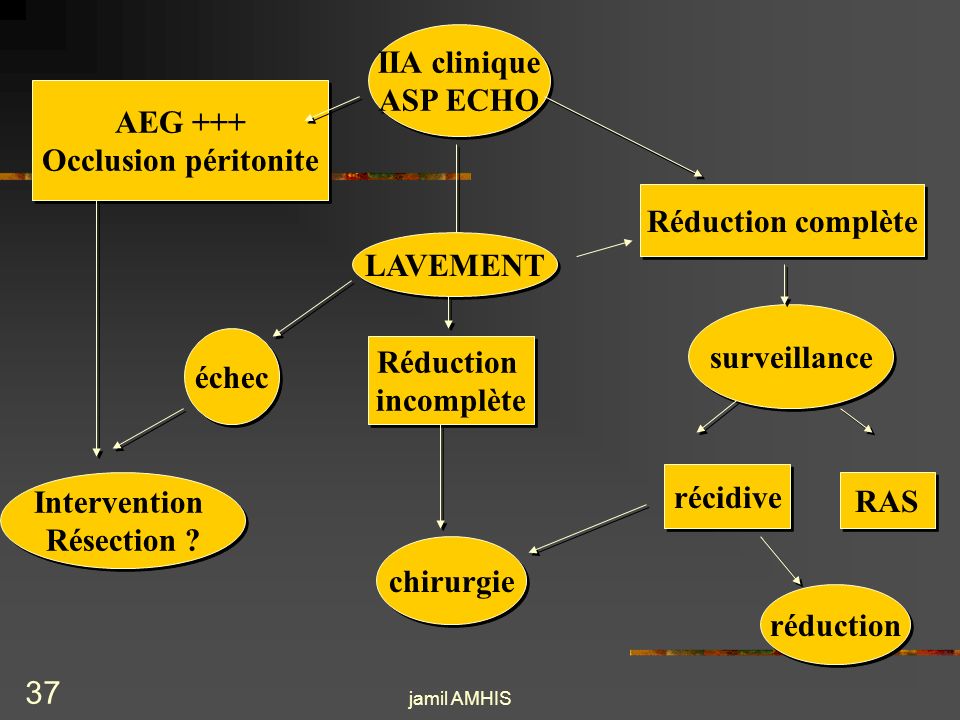 IIA clinique ASP ECHO AEG +++ Occlusion péritonite Réduction complète