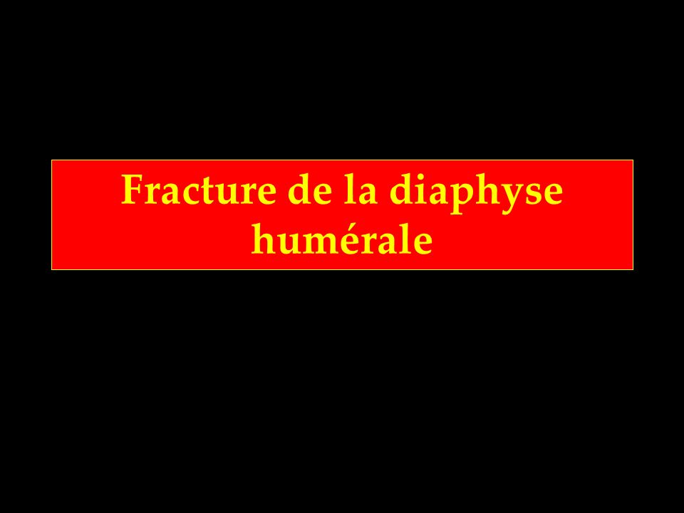 Fracture de la diaphyse humérale