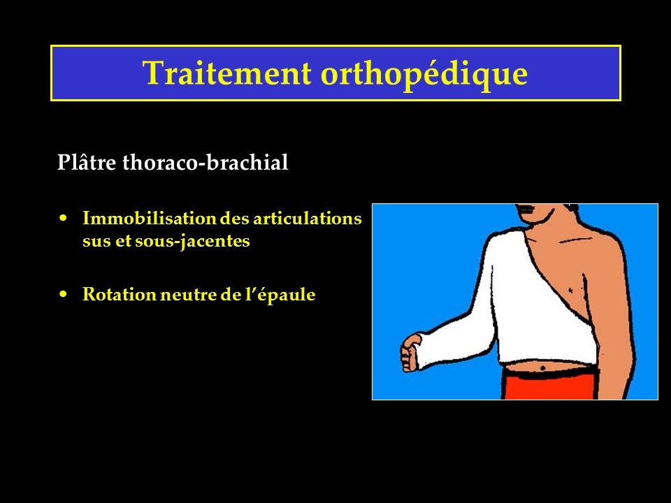 Traitement orthopédique