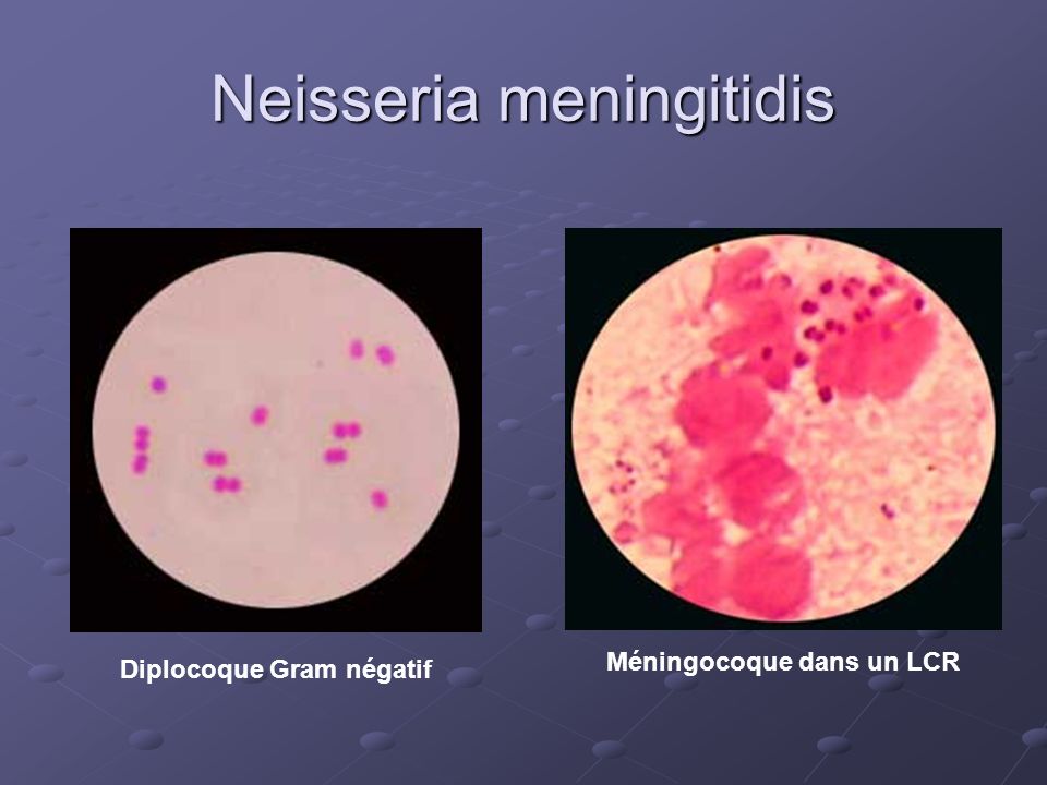 Менингококки микробиология. Нейссерия менингококк. Менингококки Neisseria meningitidis. Нейссерия менингитидис.